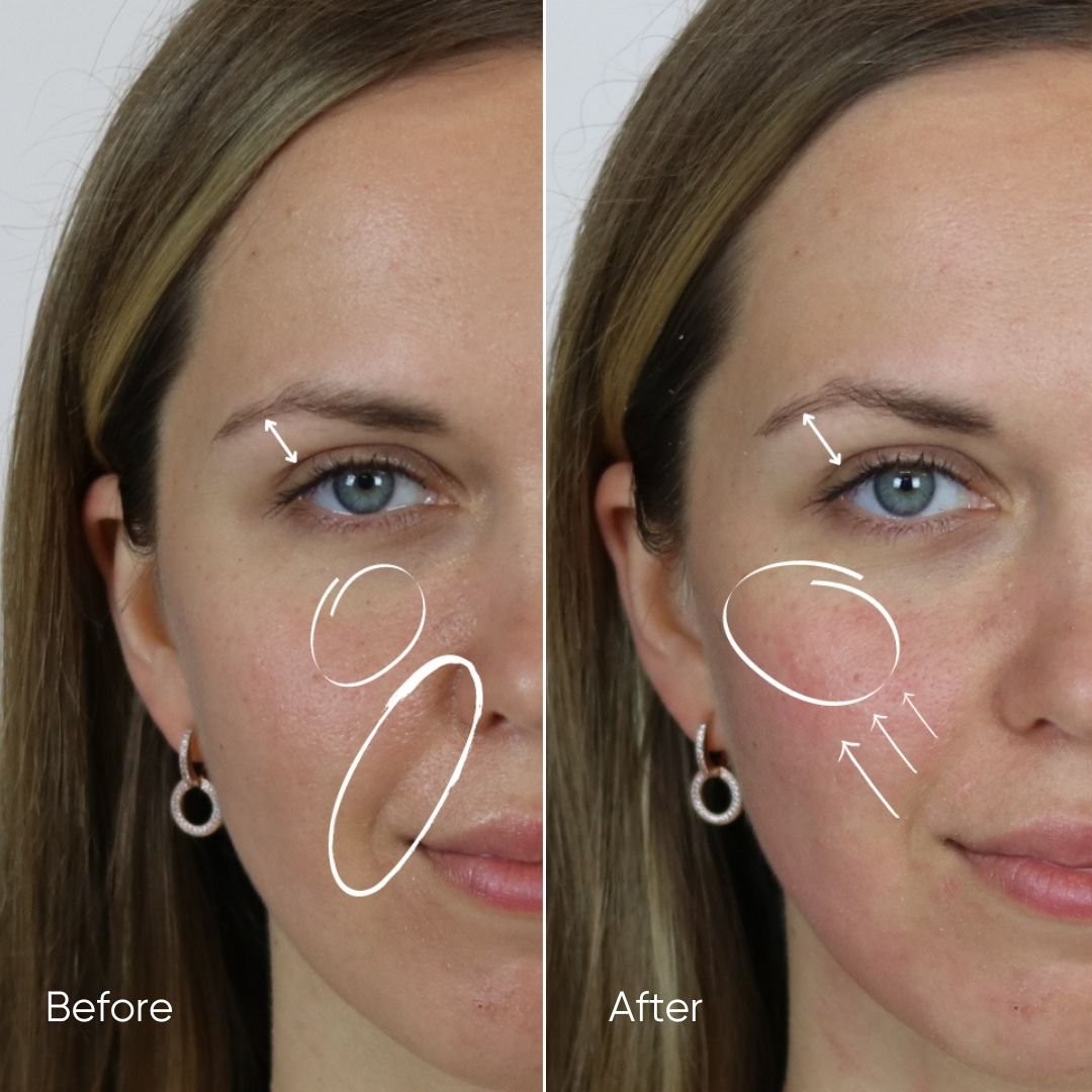 Zemits HydroVerstand PRO Sistema HydroDiamond™ 7-en-1